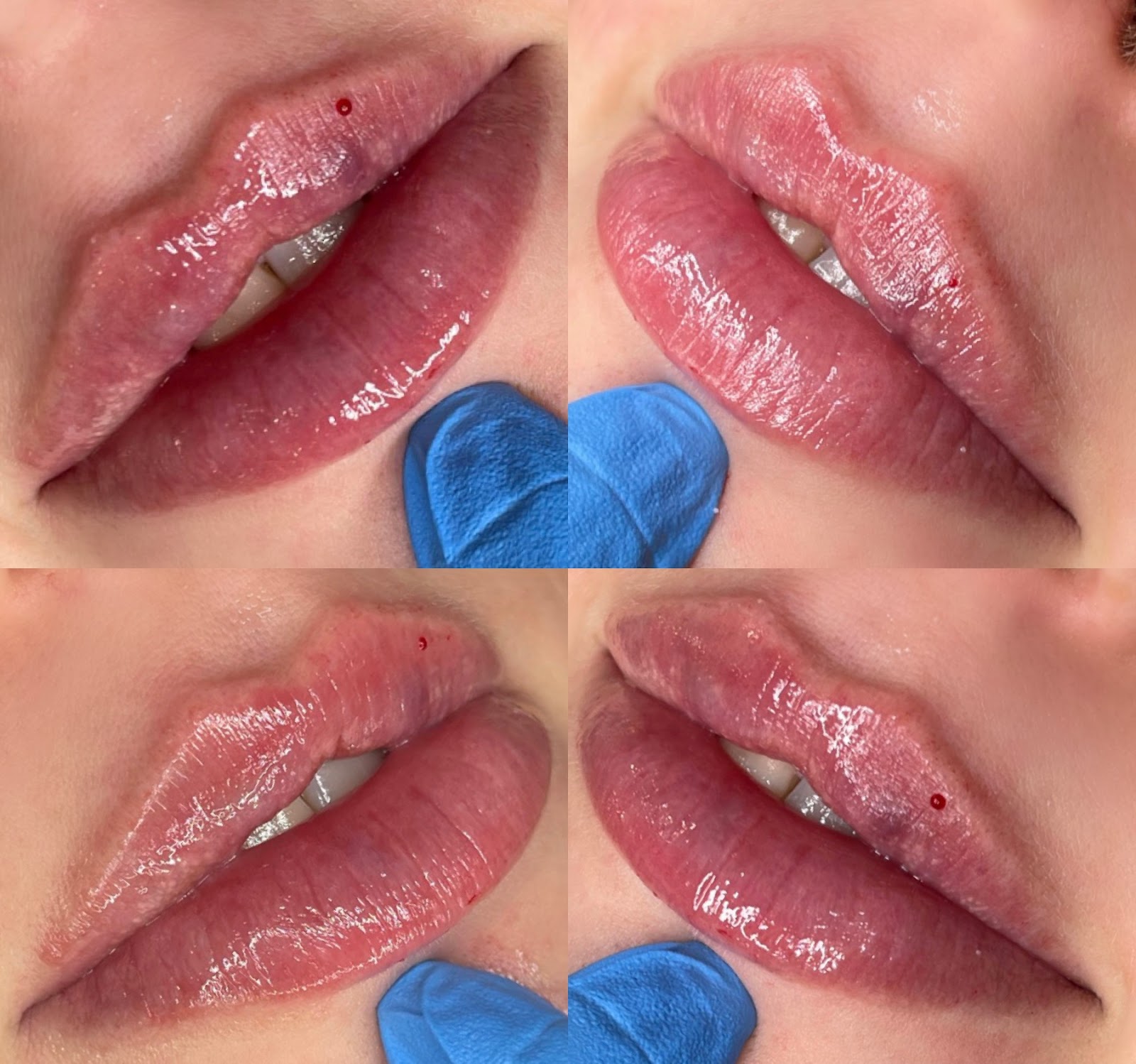 Aesthetics by Teri Louise